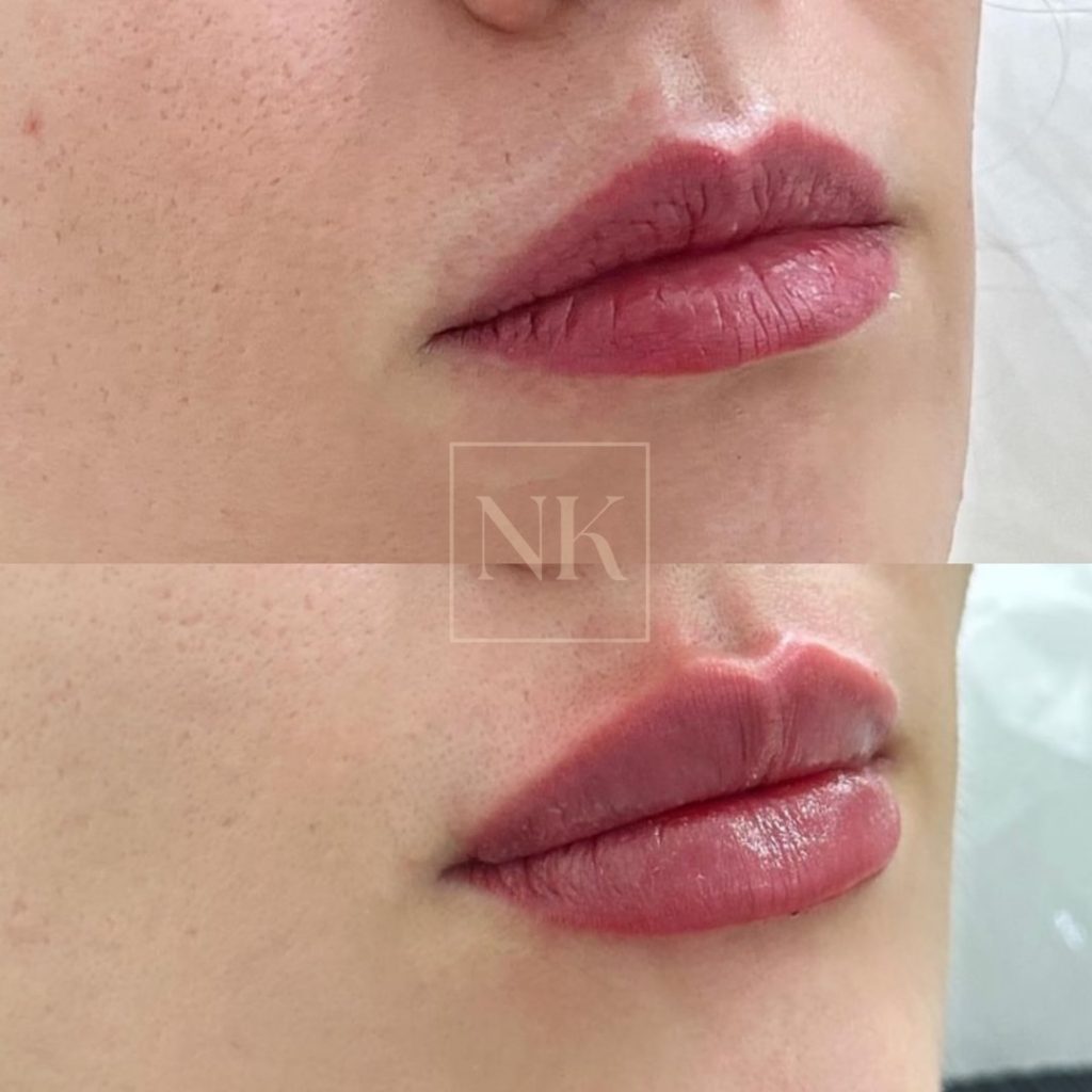 nkklinic_463641760_17983414904739622_6909386930990016390_n (1)