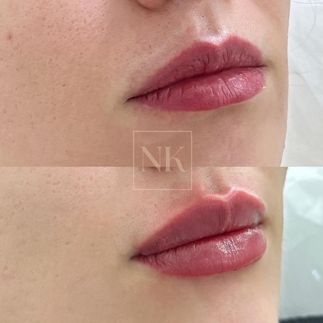 nkklinic_463641760_17983414904739622_6909386930990016390_n