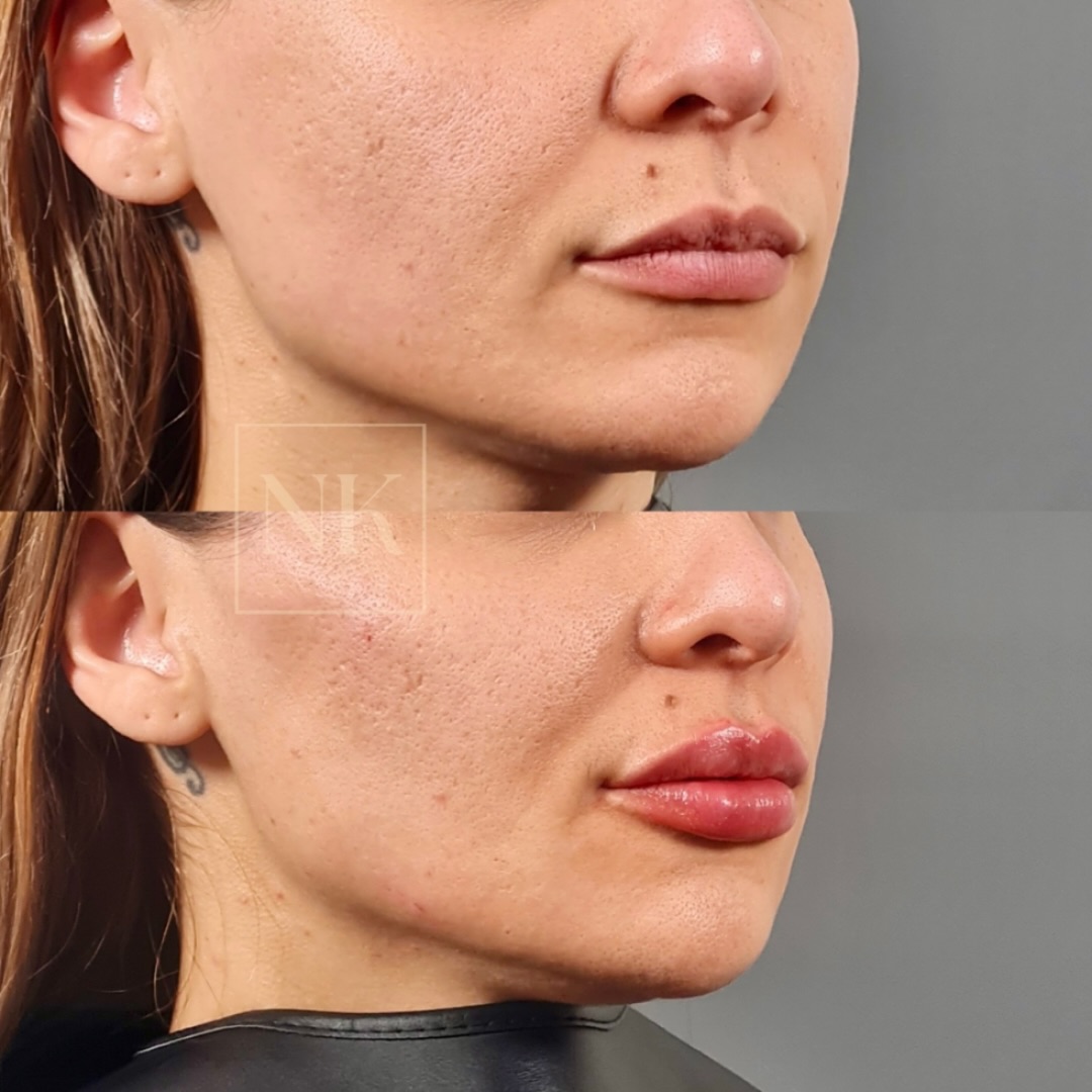 nkklinic_465096710_17985234428739622_6376288254991375693_n