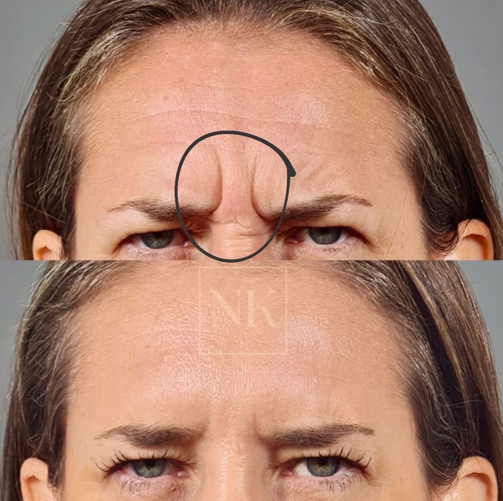 nkklinic_470427527_797238752536928_3734398643295712658_n