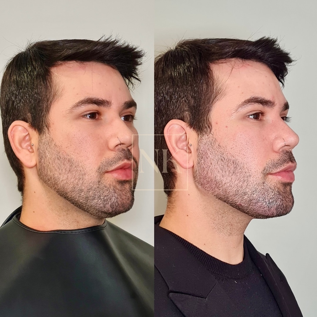 nkklinic_473779215_1068124045065626_2240739856696204645_n