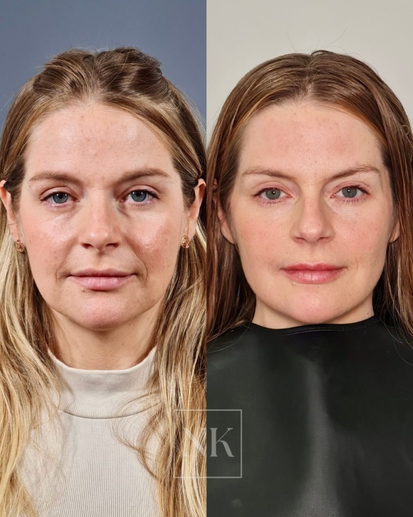 nkklinic_482612484_18000377531739622_8580321532704975756_n