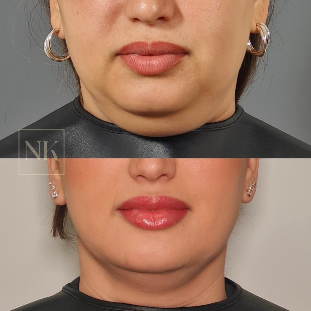 WhatsApp Image 2025-04-02 at 15.58.15