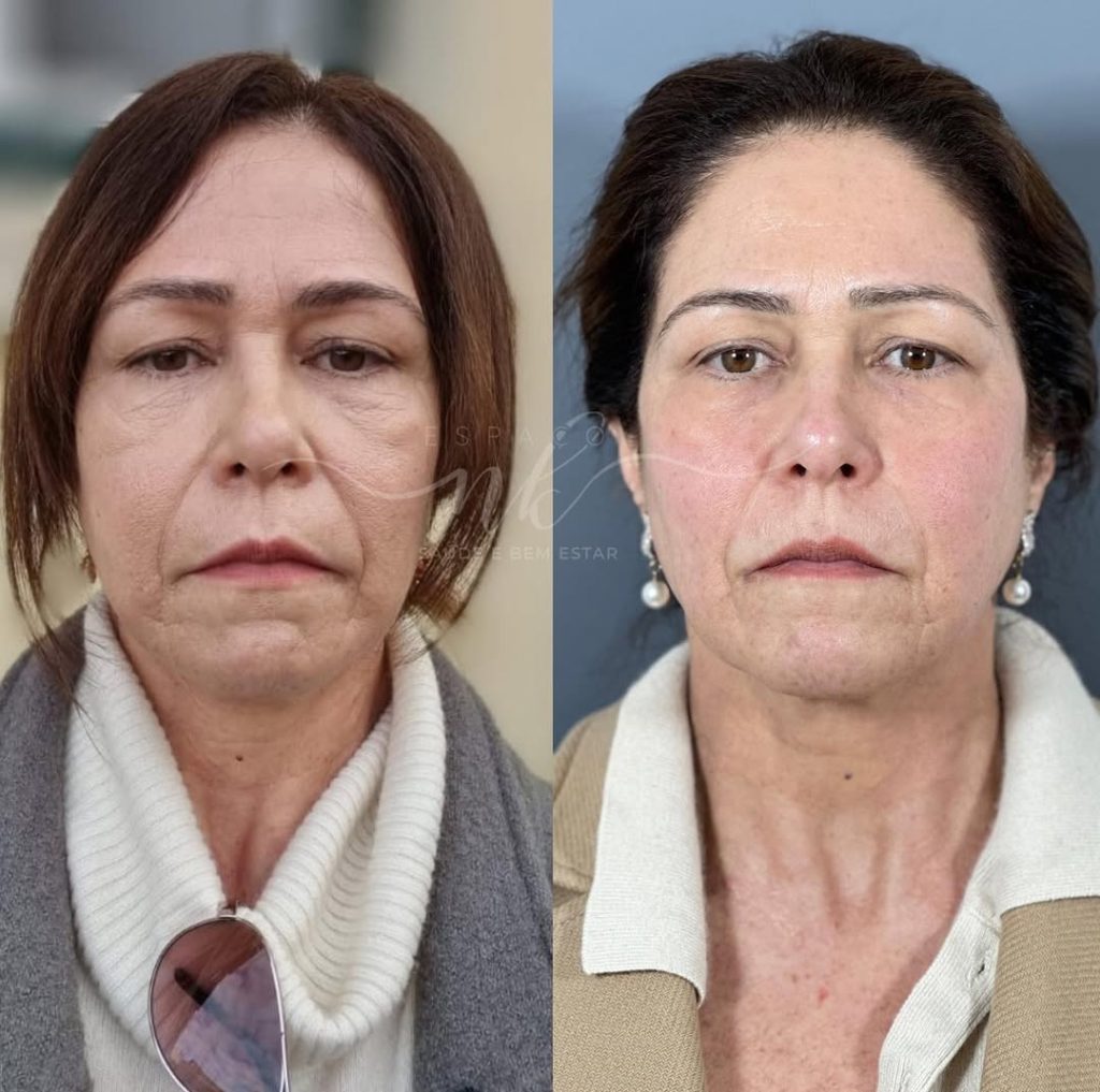 WhatsApp Image 2025-04-02 at 16.04.05