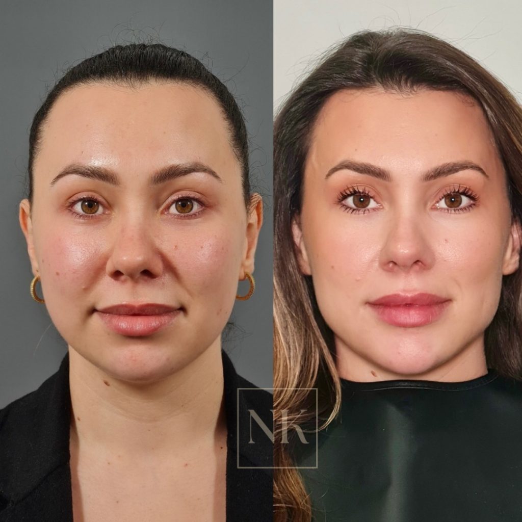 WhatsApp Image 2025-04-04 at 17.16.45