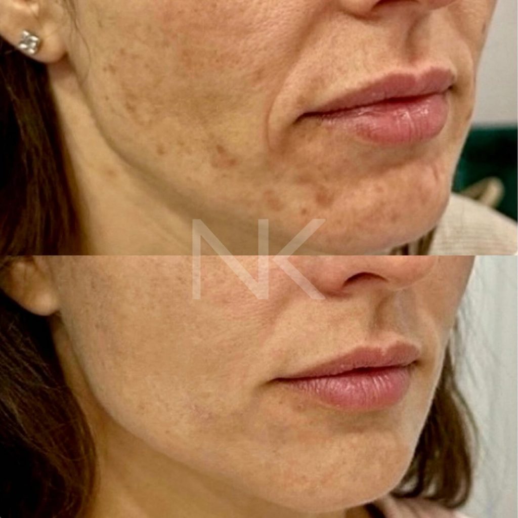 WhatsApp Image 2025-04-04 at 17.19.22